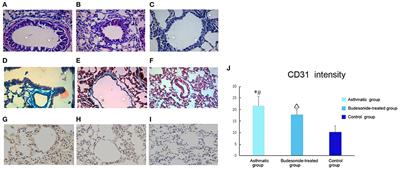 ORMDL3 Promotes Angiogenesis in Chronic Asthma Through the ERK1/2/VEGF/MMP-9 Pathway